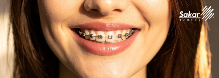 Imágenes de blog sakar dental (7)