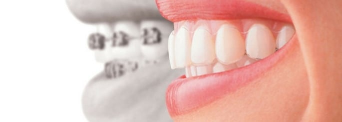 4-funciones-ortodoncista.jpg