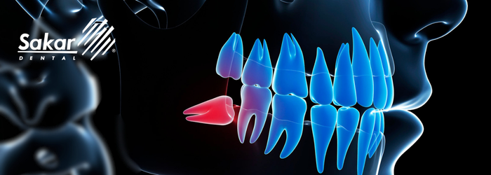 clínica-dental-en-polanco (3)-Sep-01-2026-06-55-59-7598-PM