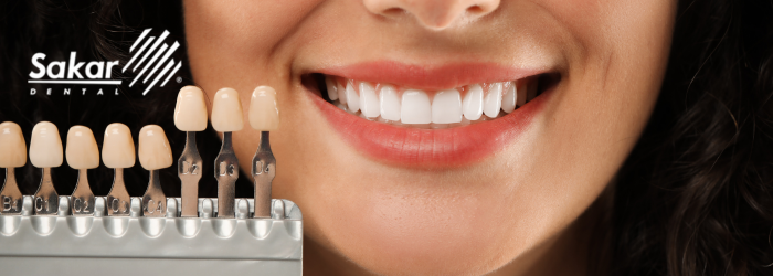 clinica-dental-en-polanco-carillas