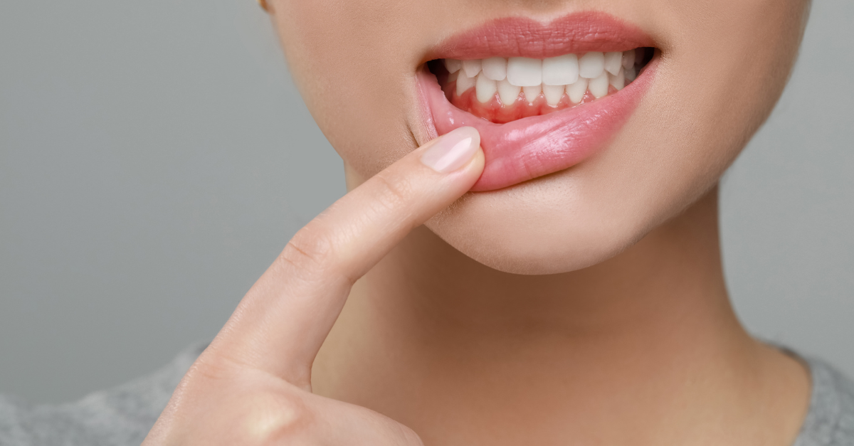 ¿Cuál es el impacto de la periodontitis en la salud general del paciente?