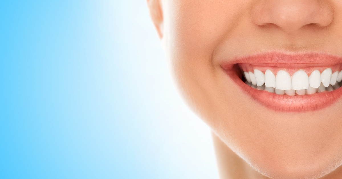 ¿Cuánto tiempo suele durar el efecto del blanqueamiento dental?