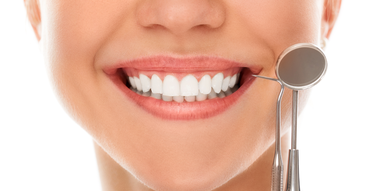 Alimentos que debes evitar después de un blanqueamiento dental