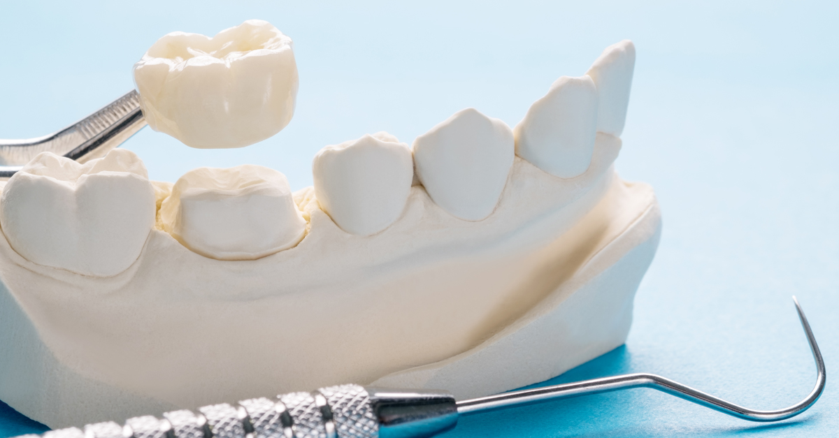 ¿Cuáles son los beneficios de usar prótesis dentales en términos de salud bucal y calidad de vida?