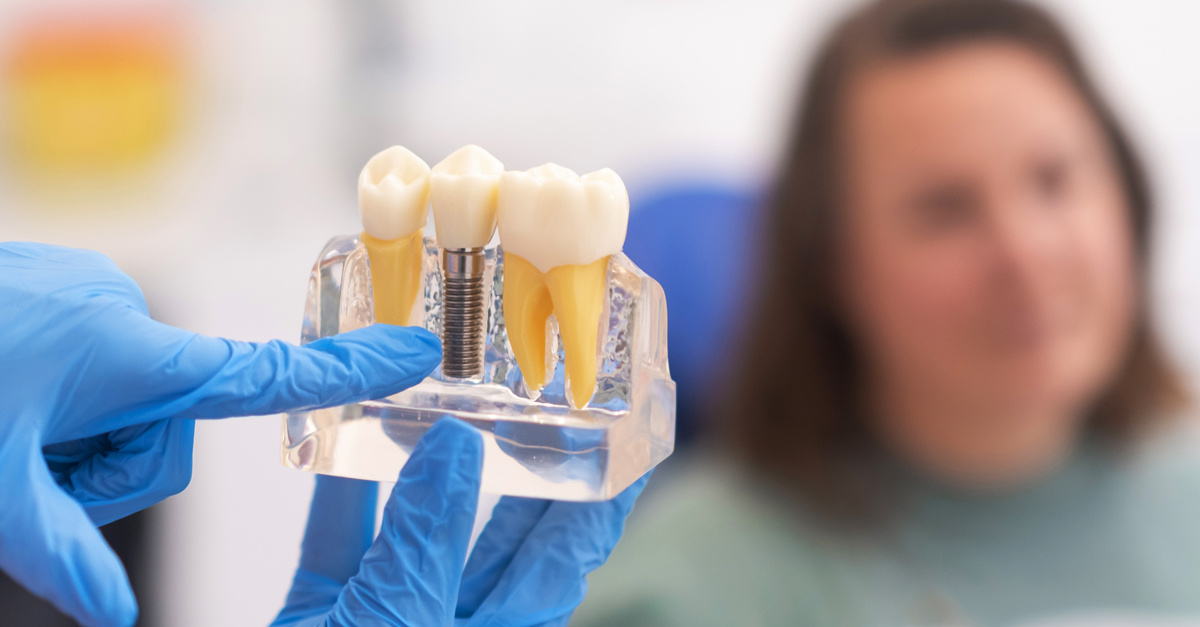 ¿Cuáles son las diferencias entre prótesis dentales removibles y fijas, y cuándo se utilizan una u otra?