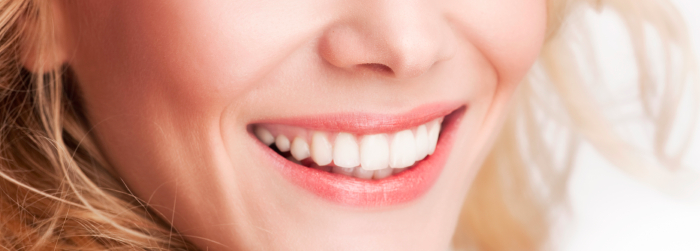 Diseño de sonrisa: ideal para tener dientes perfectos