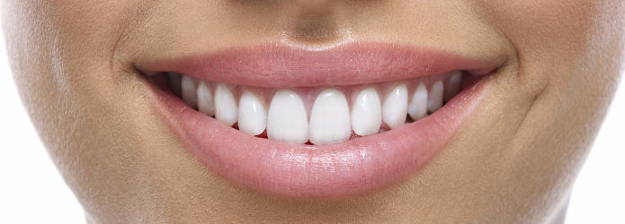 La importancia del contorno gingival para las carillas dentales