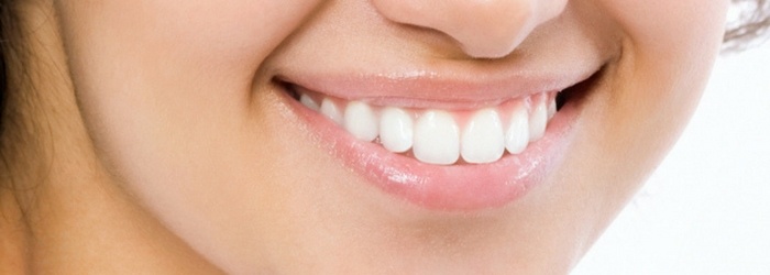 8 cosas que debes saber sobre carillas dentales estéticas