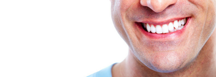 Carillas dentales o blanqueamiento dental, ¿cuál es mejor en diseño de sonrisa?