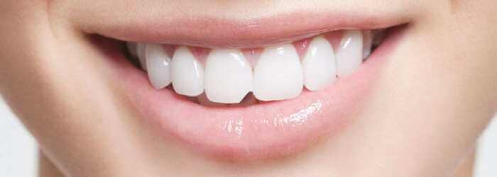 Lesiones dentales comunes y su tratamiento