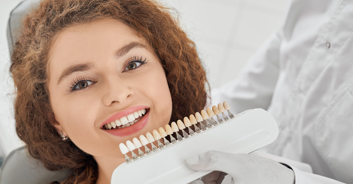 ¿Existen distintos tipos de carillas dentales?